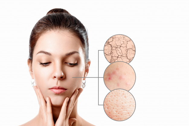 Skin Barrier yang rusak dan penyebabnya