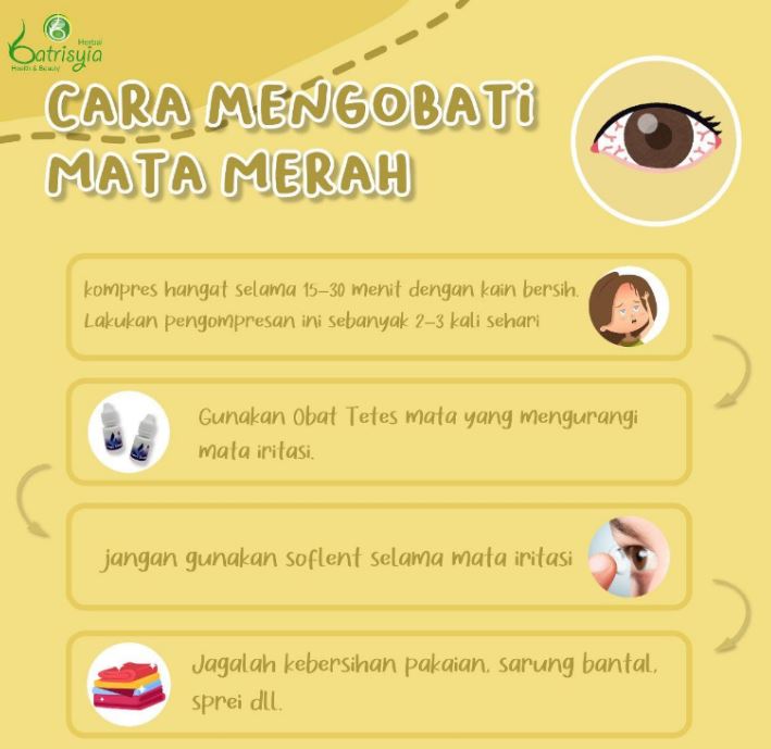 Tips atasi mata merah 