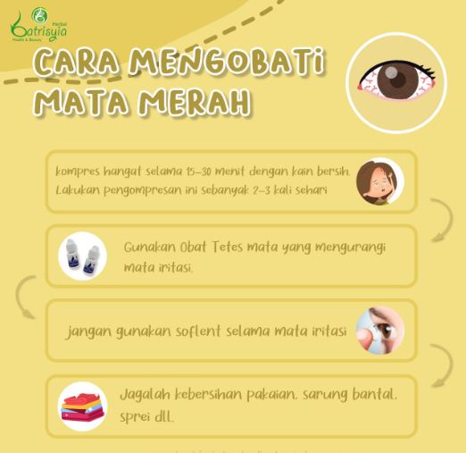 cara mudah atasi mata merah 