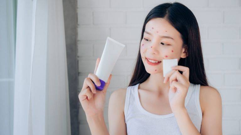 Skincare terbaik atasi jerawat 