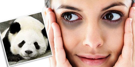 Tips Mengatasi Mata Panda Secara Alami