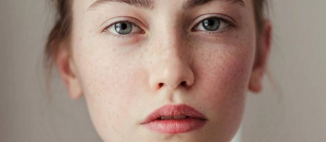 Fakta Menarik Tentang Freckles